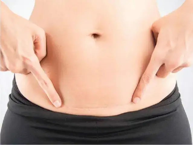 Fugacar Là Gì Và Công Dụng Chính