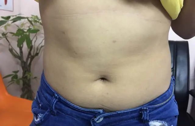 Ngứa Da Và Nóng Rát Khó Chịu