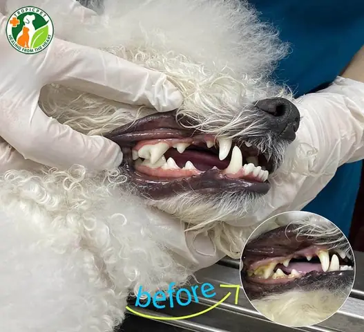 Bước 4: Theo Dõi Sau Khi Lấy Cao Răng