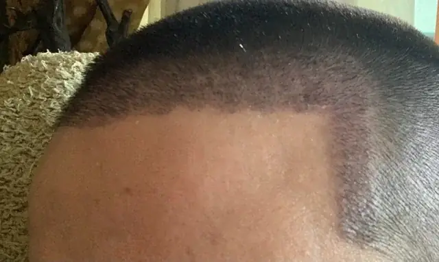 Mật Cá Hói Để Làm Gì? Công Dụng Và Cảnh Báo Từ Chuyên Gia Về Loài Cá Da Trơn Quý Hiếm