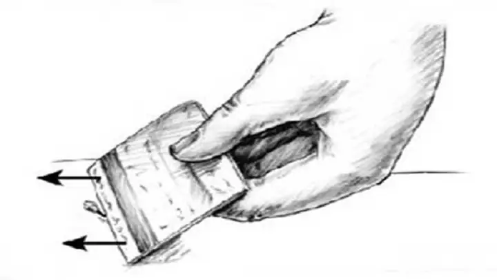 Tìm Vị Trí Bị Đốt, Lấy Mũi Kim Tìm Vị Trí Bị Đốt, Lấy Mũi Kim