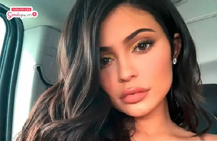 Có Nên Giữ Dáng Môi Cá Trê Không?