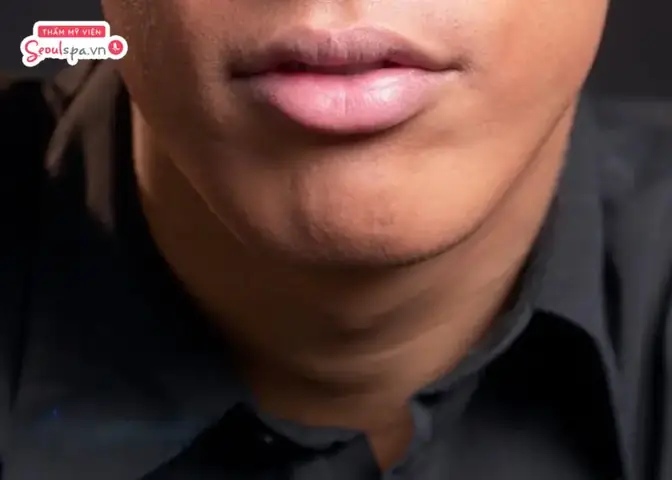 Đàn Ông Có Môi Cá Trê