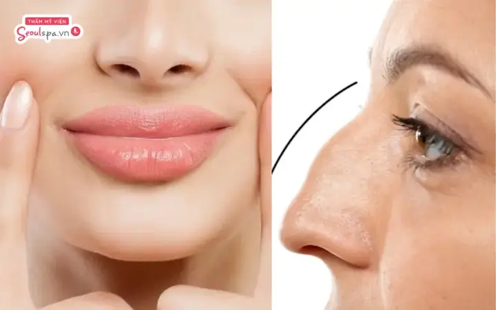 Miệng Cá Trê Với Mũi Gồ