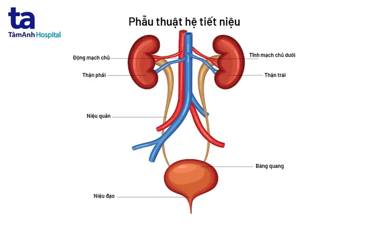 Đi Tiểu Ra Máu (đái Ra Máu) Là Gì?