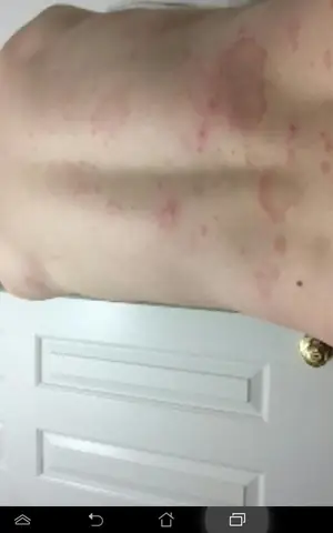 #1 Bị Nhiễm Giun Đũa Chó Mèo: Nguyên Nhân, Triệu Chứng Và Cách Tẩy