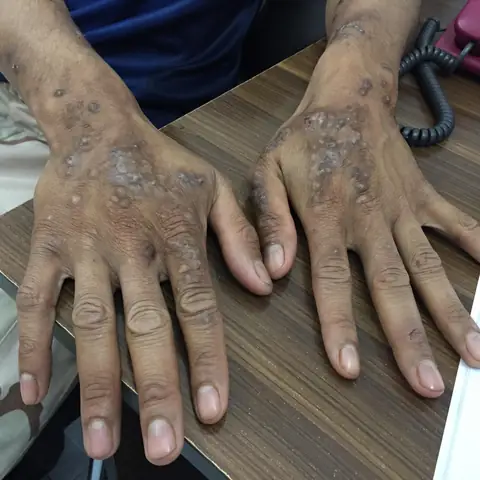 Địa Chỉ Đáng Tin Cậy Cho Xét Nghiệm & Điều Trị Bệnh Giun Đũa Chó Mèo