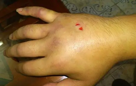 Nọc Độc Vây Cá Ngát Cướp Sinh Mạng Một Phụ Nữ - Báo Vnexpress ...