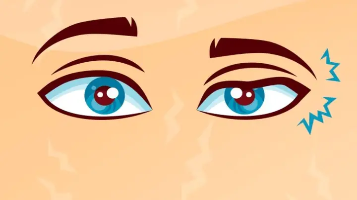 18cải Thiện Tình Trạng Co Giật Mi Mắt