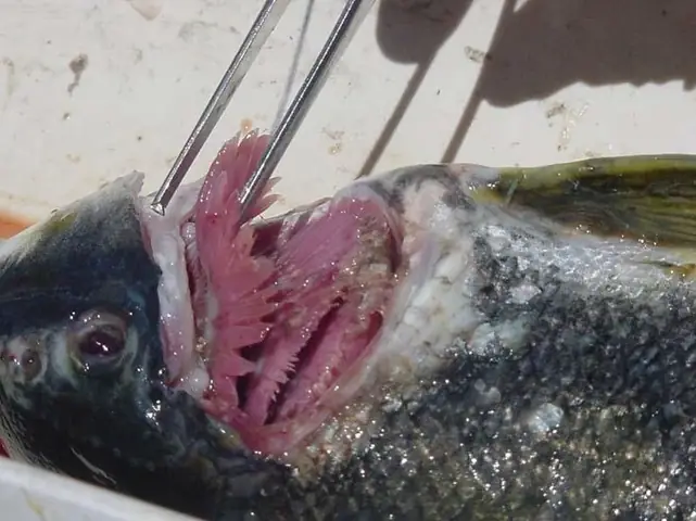 Sán Cá Rô Phi: Nguyên Nhân, Triệu Chứng, Biến Chứng Và Cách Phòng Tránh