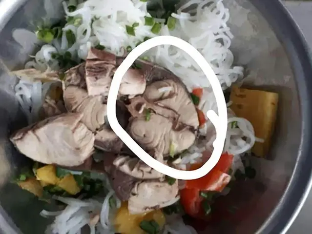 Sán Trong Ruột Cá Là Gì? Dấu Hiệu, Cách Phòng Tránh Và Xử Lý Khi Ăn Phải