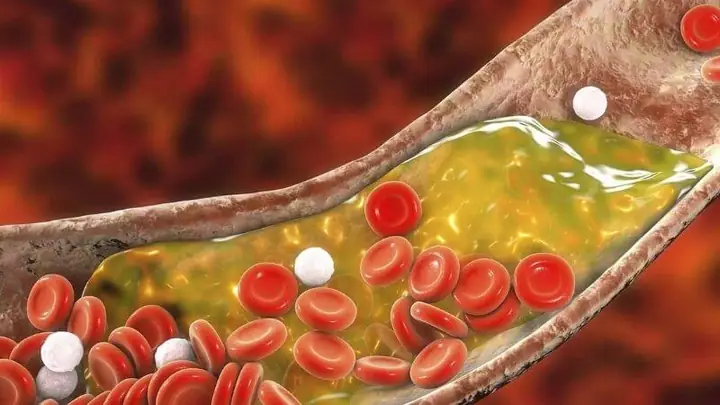 Giảm Mức Cholesterol Máu