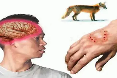 Đám Tang Rất Nhiều Âm Khí