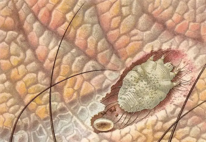 Cách Chữa Trị Bệnh Ghẻ Ở Chó