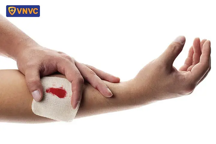 Cách Sơ Cứu Khi Bị Chó Cắn Chảy Máu Ít