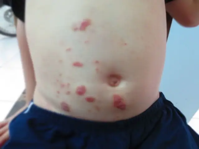 Xét Nghiệm Sán Chó Bao Nhiêu Tiền Và Khi Nào Nên Đi Xét Nghiệm