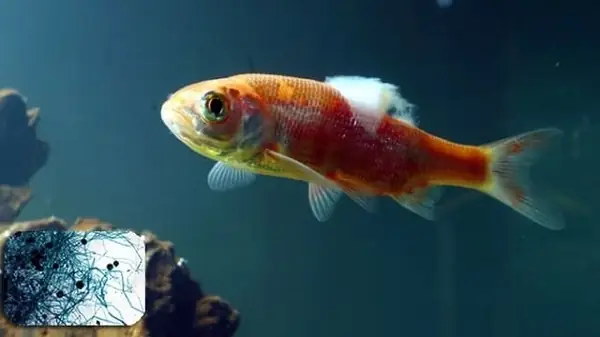 Bệnh Nấm Cá Là Gì? Bệnh Nấm Cá Là Gì?