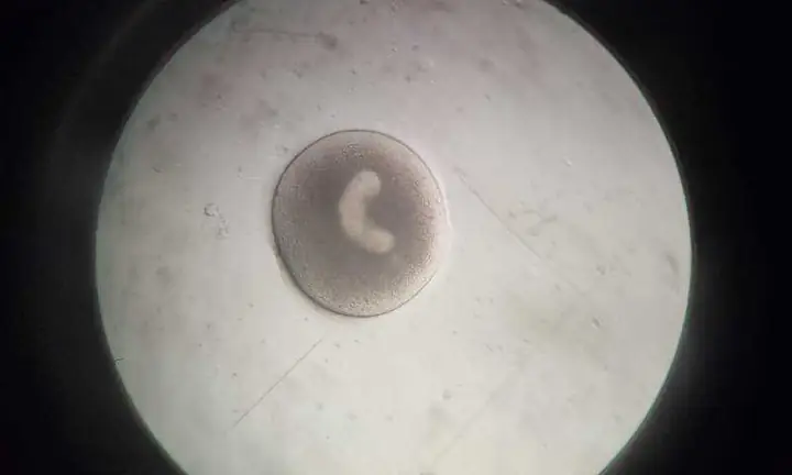 Bệnh Đốm Trắng (trùng Quả Dưa) – Koilover